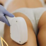 Depilación Láser en Spas: Efectividad y Beneficios - Sun Skin Spa
