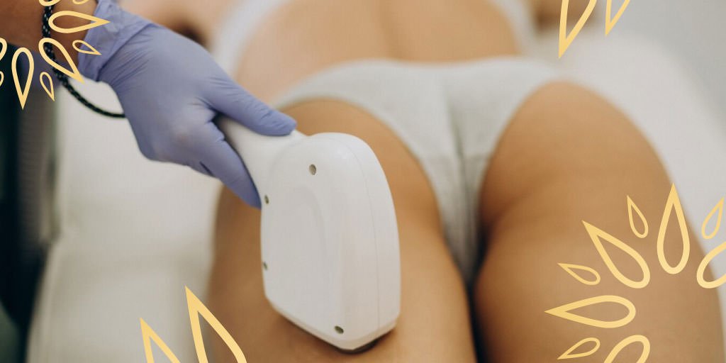 Depilación Láser en Spas: Efectividad y Beneficios - Sun Skin Spa