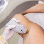 Descubre los Beneficios del Spa y la Depilación Láser