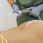 Todo lo que necesitas saber sobre el spa y la depilación láser definitiva - Sun Skin Spa