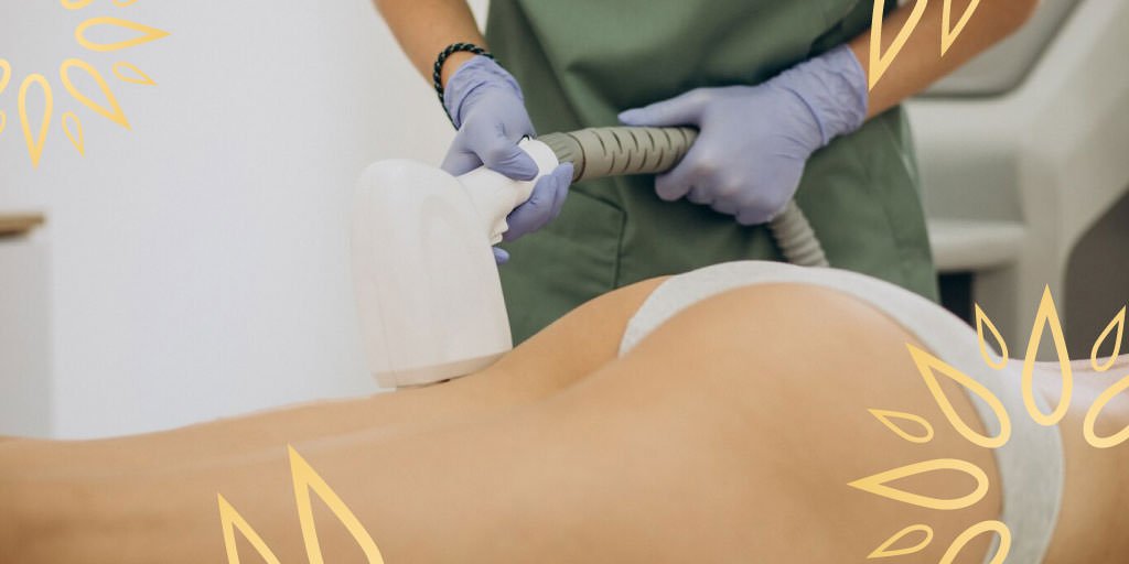 Todo lo que necesitas saber sobre el spa y la depilación láser definitiva - Sun Skin Spa